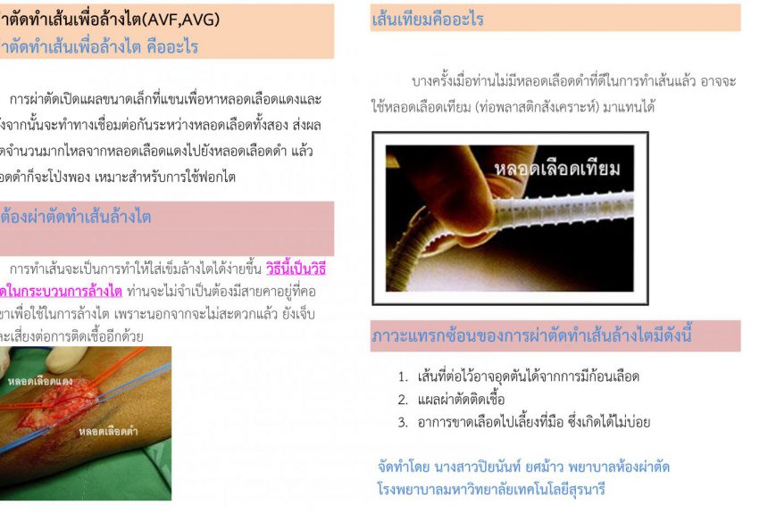 การผ่าตัดทำเส้นเพื่อล้างไต การผ่าตัดทำเส้นเพื่อล้างไต